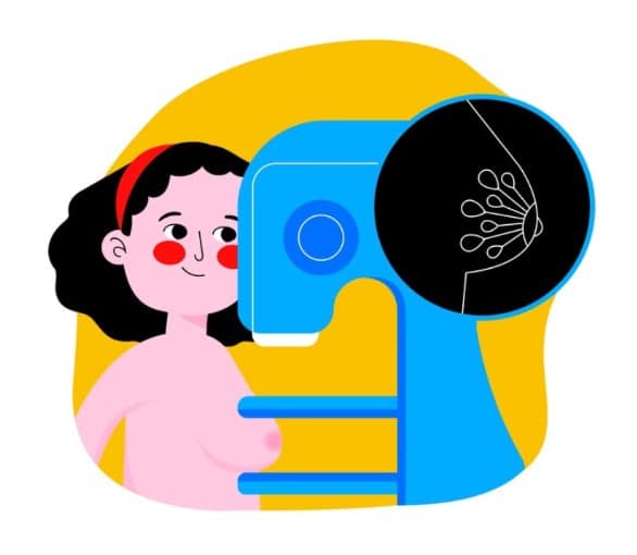 mitos sobre mamografías