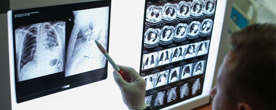 TAC de tórax con contraste