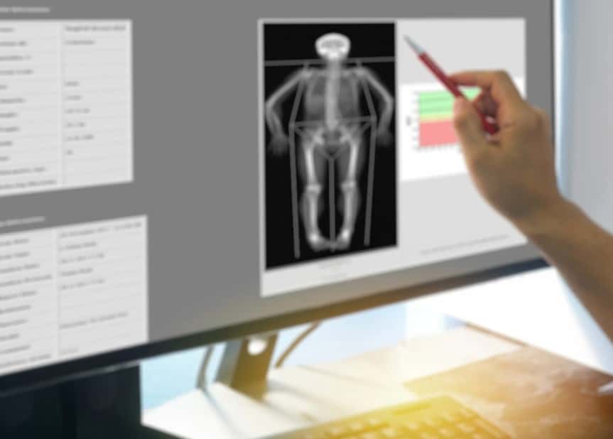 Densitometría para hombres