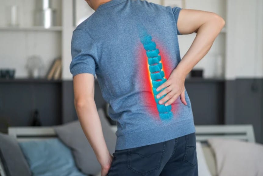 detectar una hernia lumbar